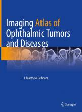 The cover of Imaging Atlas of Ophthalmic Tumors and Diseases
