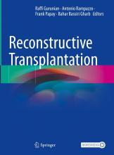 The cover of Reconstructive Transplantation