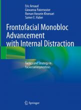 The cover of Frontofacial Monobloc Advancement with Internal Distraction