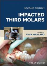 The cover of Impacted Third Molars