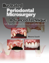 The cover of Illustrated Periodontal Microsurgery Advanced Technique