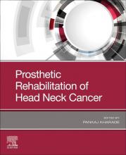 The cover of Prosthetic Rehabilitation of Head Neck Cancer
