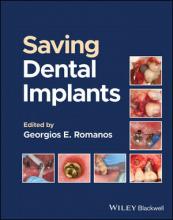 The cover of Saving Dental Implants