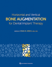 The cover of Horizontal and Vertical Bone Augmentation for Dental Implant Therapy