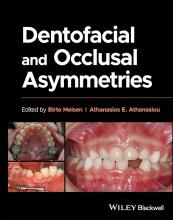 The cover of Dentofacial and Occlusal Asymmetries