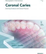 The cover of Coronal Caries