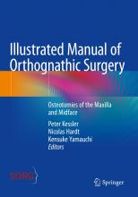 The cover of Illustrated Manual of Orthognathic Surgery